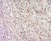 IFNA16/Interferon alpha 16 antibody