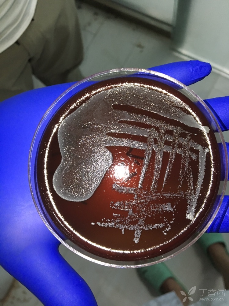 想问下这是什么菌落