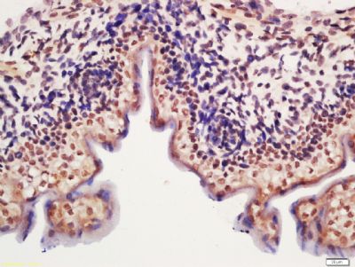 METTL11A antibody