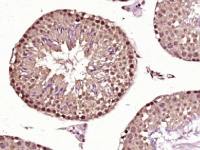 ICBP90/UHRF1 antibody