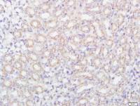 FCAR/CD89 antibody