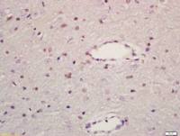 JIP1/MAPK8IP1 antibody