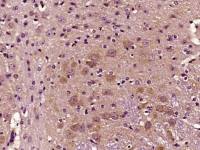 GAT1/GABA Transporter 1 antibody