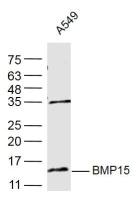 BMP15 antibody
