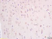RAB9 antibody