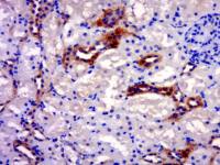 RAB20 antibody