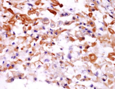 COPZ2衣壳蛋白-ζ2抗体