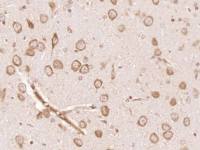 DAL1/EPB41L3 antibody