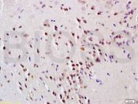 GNAT3 antibody