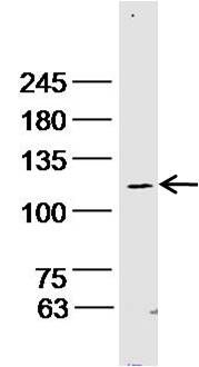 Integrin alpha-3 heavy chain antibody