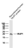 VILIP1 antibody