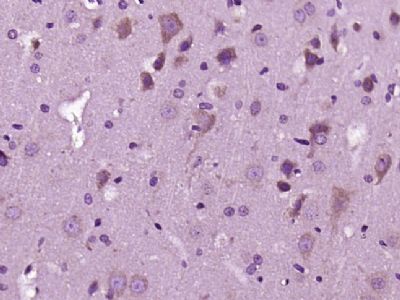 RAC1 + RAC2 antibody