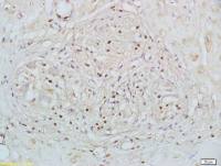 RXR beta antibody