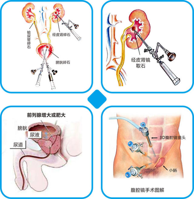 泌尿外科配图.jpg