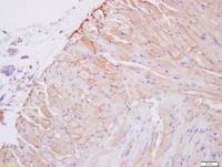 Collagen VIII alpha 1 antibody