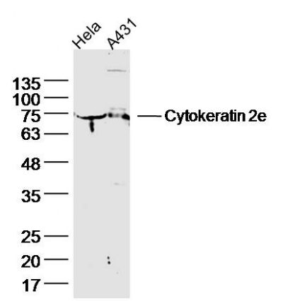 Cytokeratin 2e细胞角蛋白2e抗体