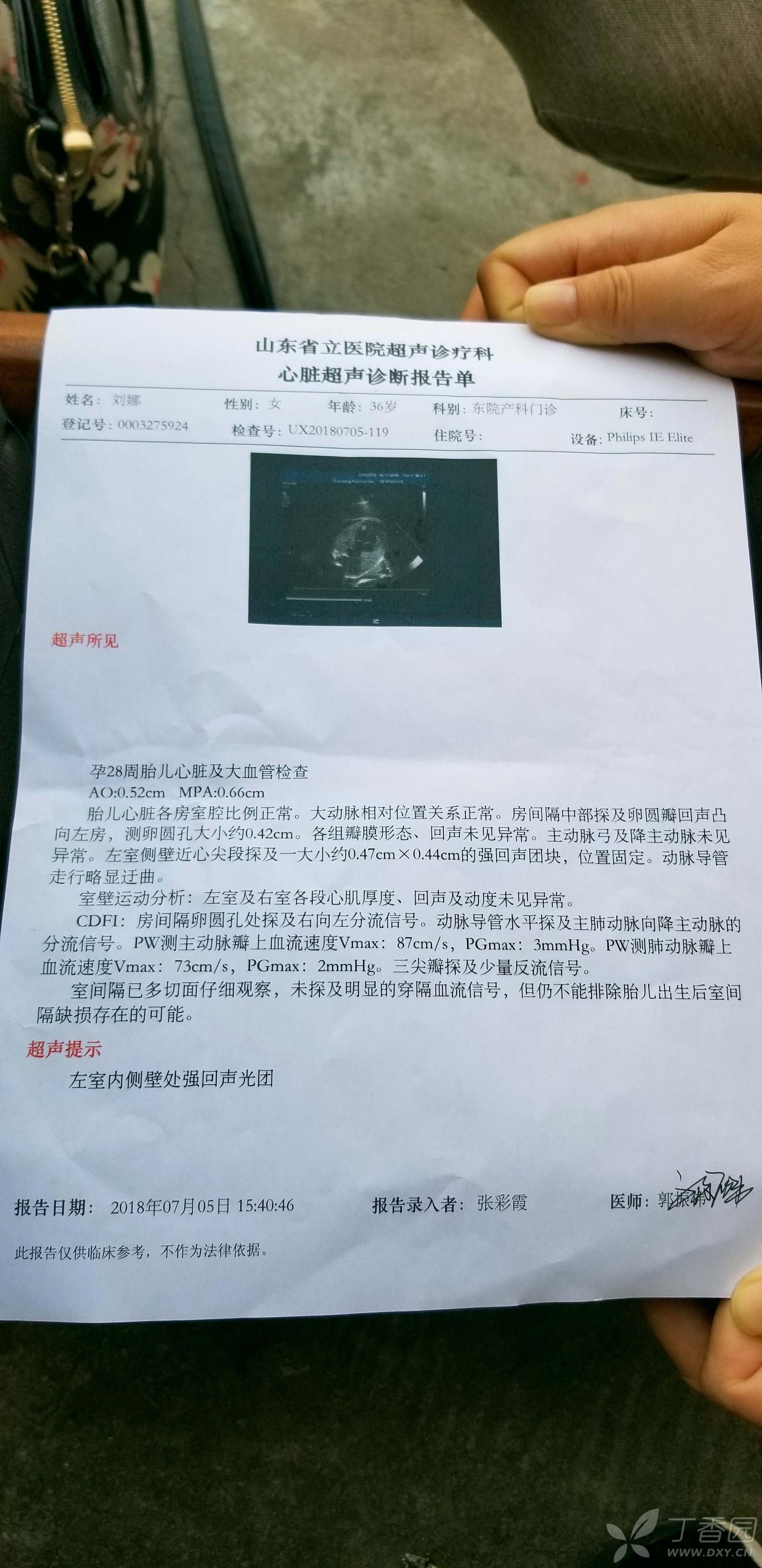 孕28周心脏彩超发现左室侧壁近心尖段强回声团块0.47cm*0.