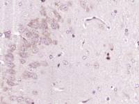 SIRT2 antibody