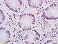 Aquaporin 8 antibody