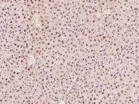 Histone H4 (tri methyl K20) antibody