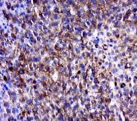 MAGEB6 antibody