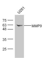 MMP9 antibody