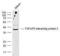 TNFAIP3 interacting protein 3 antibody