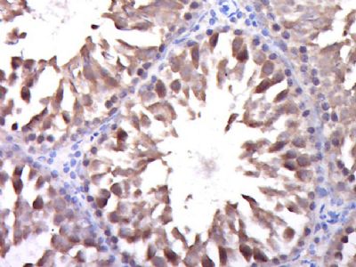 DGKK甘油二酯激酶κ/DGK-κ抗体