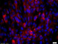 Biglycan antibody