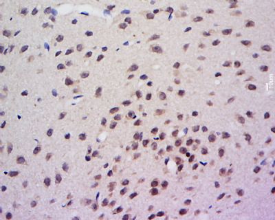 AHR芳香烃受体抗体