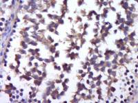 GSK3 Alpha + Beta antibody