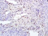TIA1 antibody