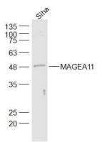 MAGEA11 antibody
