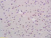 Mkl1 antibody