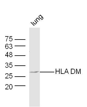 HLA DM antibody