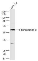 Fibrinopeptide B antibody