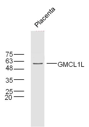GMCL1L antibody