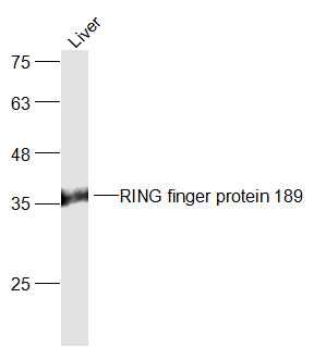 RING finger protein 189 antibody
