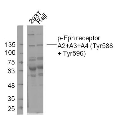 phospho-Eph receptor A2+A3+A4 (Tyr588 + Tyr596) antibody