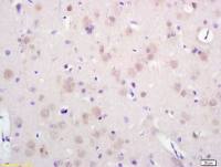 SEC14 like protein 2 antibody