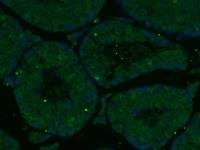 Wilms Tumor Protein antibody