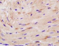 Creatine Kinase MM antibody