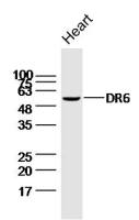 DR6 antibody
