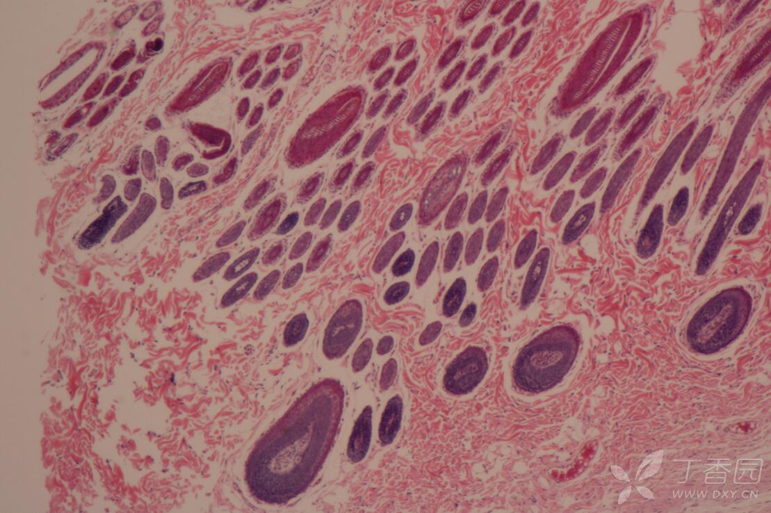 请教皮肤切片he染色附属器辨认,谢谢 - 实验动物与组织学技术讨论版