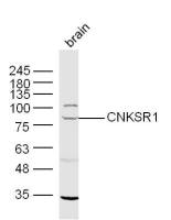 CNKSR1 antibody