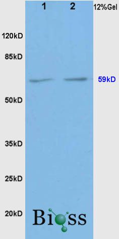 BMPR1A骨成型蛋白受体1A抗体