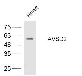 AVSD2 antibody