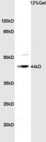 TBX1 antibody