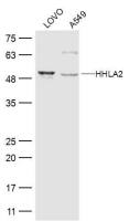 HHLA2 antibody