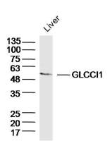 GLCCI1 antibody